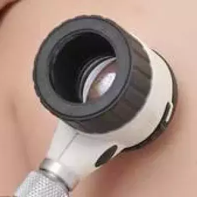 Angiom: Definition, Therapie und Behandlung, wie lässt es sich entfernen und was ist betroffen: Haut, Lippen, Gehirn und Leber?