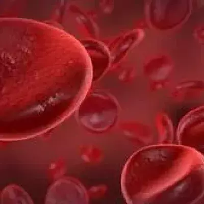 Leukämie: Definition und Formen, Ursachen, Symptome, Therapie und Behandlung, Heilungschancen, um was handelt es sich?
