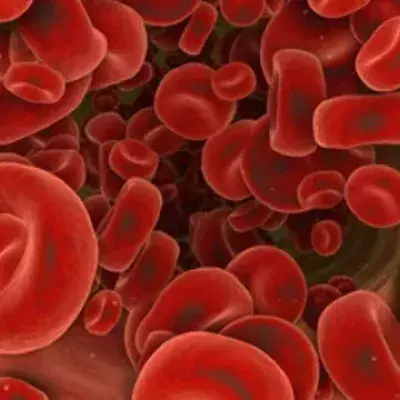 Blutvergiftung: Definition, Anzeichen und Symptome, Ursachen, Behandlung und Therapie, Was ist die Sepsis?