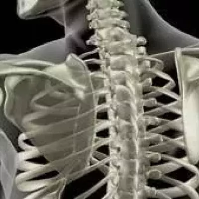 Osteoporose: Symptome, Therapie, Behandlung, Ernährung, Ursachen und Medikamente