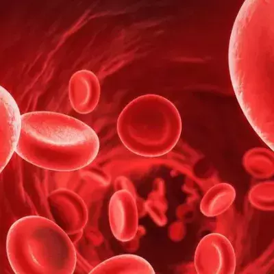 Anämie / Blutarmut: Symptome, Ursachen und Therapie