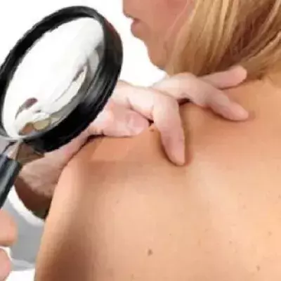 Lupus erythematodes: Was ist das? Symptome, Diagnose, Ursachen und Behandlung der Krankheit