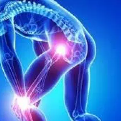 Morbus Sudeck: Hand, Fuß, Symptome und Behandlung