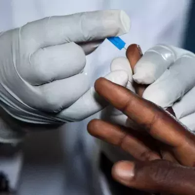 Durch Corona-Impfung könnte Aids zunehmen