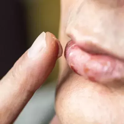 Verhindert Lippenbalsam die Ausbreitung von Covid-19?