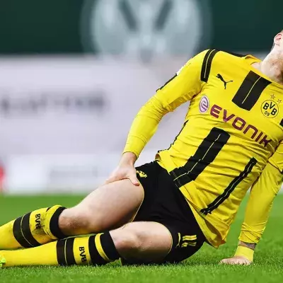 Marco Reus fiel schon oft aus, trotzdem führt er die Liste der am häufigsten verletzen Spieler nicht an.