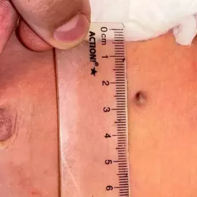 Das Baby wurde im Mutterleib angeschossen.