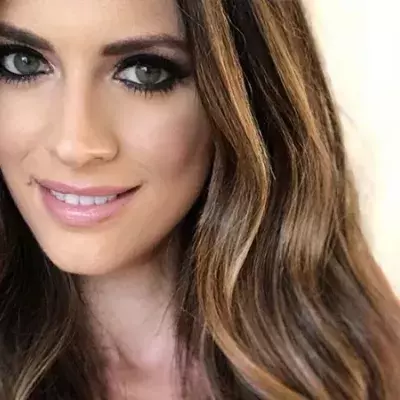 Ehemaliges Model zeigt offen ihre Hautkrankheit ohne Make-up-Schicht