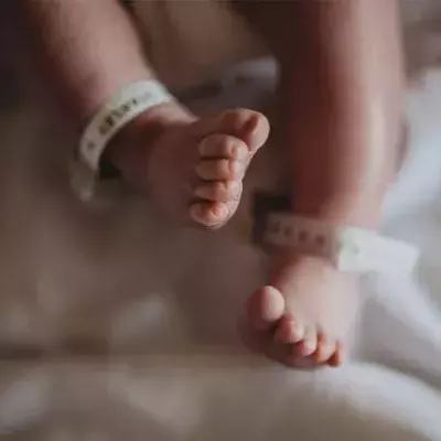 Langersehntes Baby kommt mit Hautkrankheit zur Welt