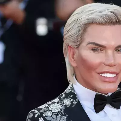 "Menschlicher Ken": So sah Rodrigo Alves früher aus