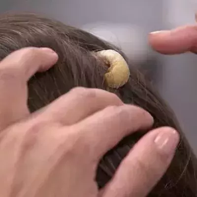 Riesige Beule am Kopf