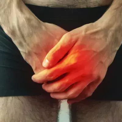 Verkalkter Penis