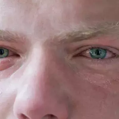 Aus diesem erstaunlichen Grund röten sich unsere Augen nach dem Weinen