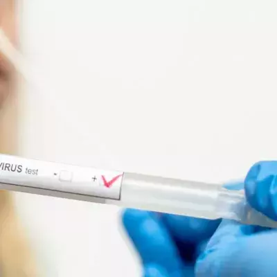 PCR-Test