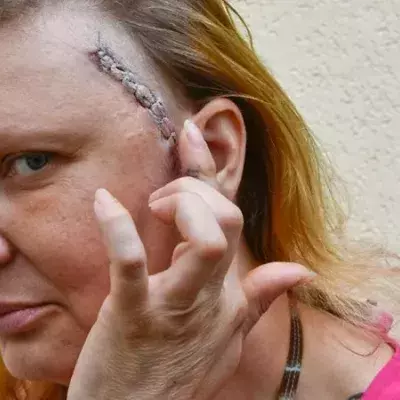 Mann (33) schlägt Frau (44) fast tot: Das Urteil sorgt für Empörung!