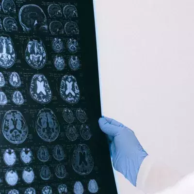 Fortschritt in der Demenzforschung: Forscher:innen machen wichtige Entdeckung