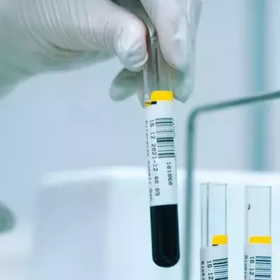 Ist die Behandlung mit Nabelschnurblut die Lösung im Kampf gegen HIV?