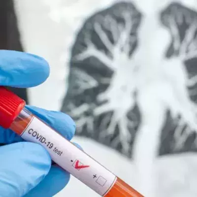 Ab welchem Zeitpunkt ist ein Covid-19-Patient nicht mehr ansteckend?