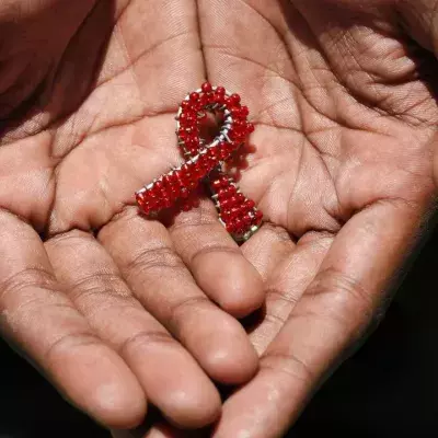 Aids-Erkrankungen nehmen drastisch zu seit der Corona-Pandemie