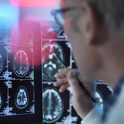 Alzheimer: Erster Nasenspray-Impfstoff soll am Menschen getestet werden