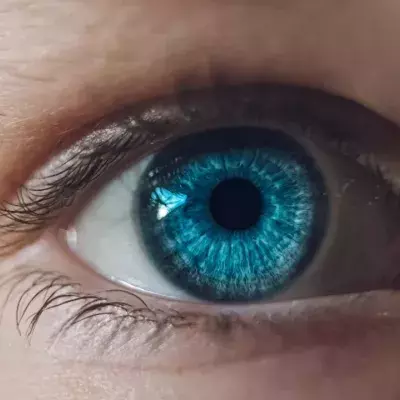 Auge