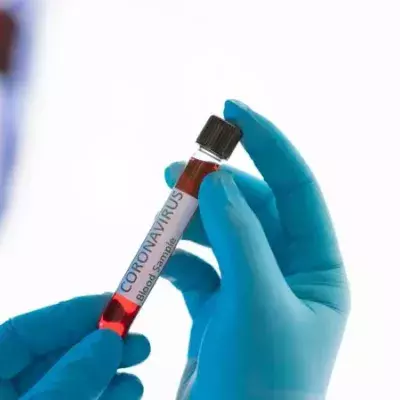 Covid-19: Diese Studie zu infizierten Pflegekräften verrät uns mehr über die Immunität