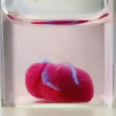 Forschern gelingt es, lebenswichtiges Organ aus menschlichem Gewebe 3D zu drucken