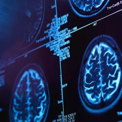 Forschung: Geräusche und Licht wirken sich positiv auf Alzheimer-Patienten aus