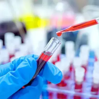 HIV-Patient geheilt 