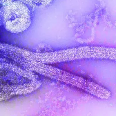 Marburg-Virus