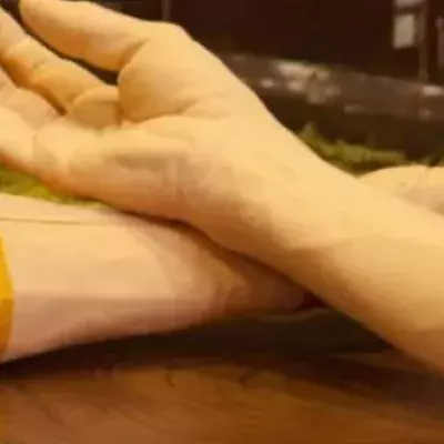 Google entwickelt ein Armband zur frühzeitigen Krebsdiagnose