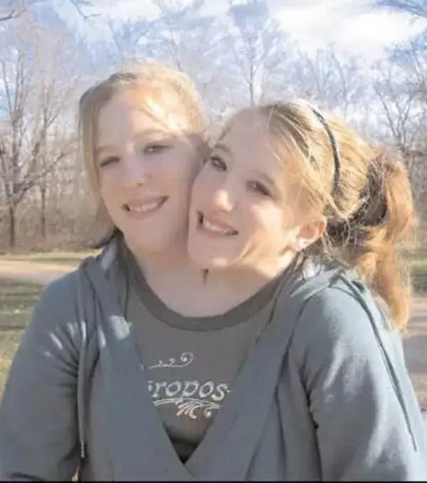 Abby und Brittany Hensel: Als sie 16 Jahre alt waren, haben sie eine Dokumentation über sich drehen lassen, die dann zu einer Serie wurde