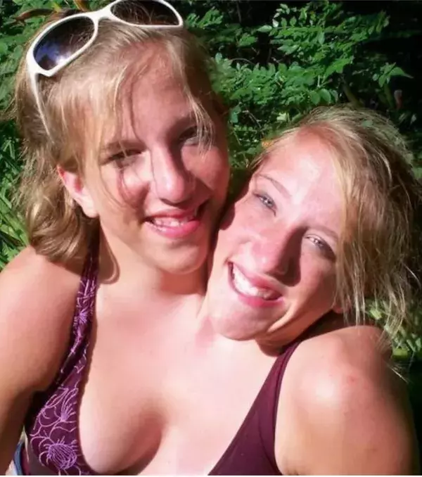 Abby und Brittany Hensel: Beide kontrollieren die Hälfte ihres Körpers