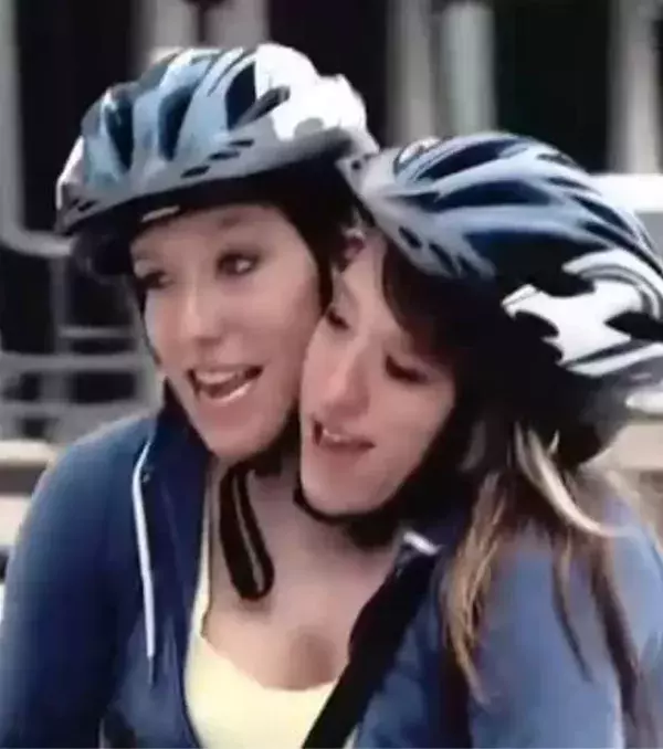 Abby und Brittany Hensel: Mit der Zeit haben sie gelernt, sich zu koordinieren. Aber das war nicht immer einfach