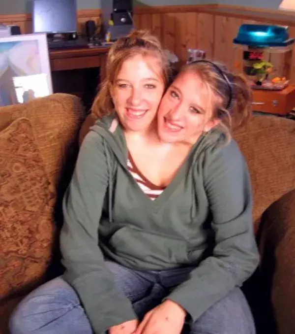 Abby und Brittany Hensel: Sie hoffen, eines Tages heiraten zu können und Kinder zu bekommen