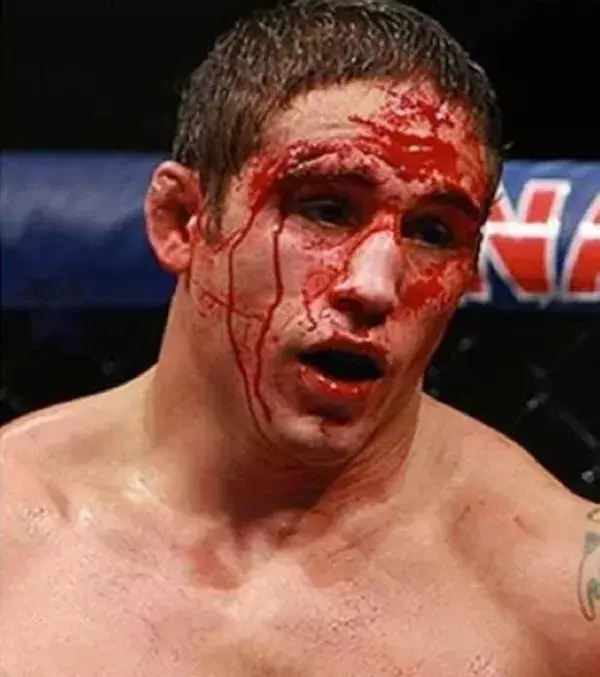Chad Mendes nach dem Kampf