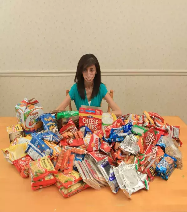 Damit Lizzie Velasquez, die hässlichste Frau der Welt genannt wird, in Form bleibt, muss sie täglich 8000 Kalorien zu sich nehmen