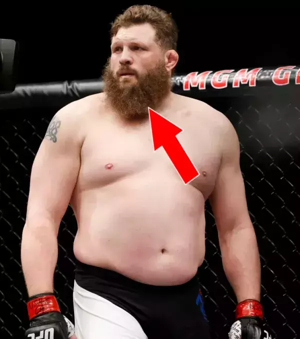 Den Kinn von Roy Nelson, sein Widerstand ist unglaublich. Er hält den Rekord für den stärksten eingesteckten Schlag. Und wenn man weiß, dass es bei der UFC 161 gegen Stipe Miocic passierte, ist es noch beeindruckender