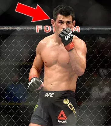 Die Intelligenz von Dominick Cruz, er kämpft großartig und nutzt seine Erfahrung, um seine Kämpfer zu besiegen
