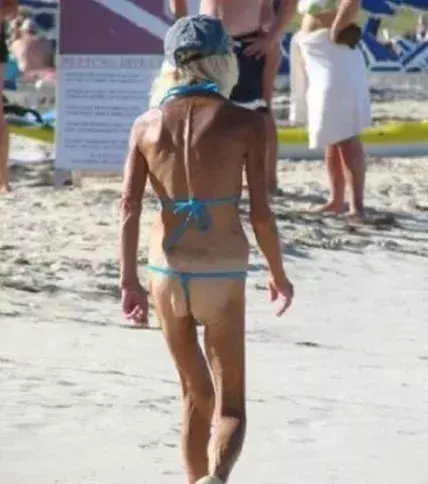 Die schlimmsten Bademoden: Ausgefallene Sonnenbräune...