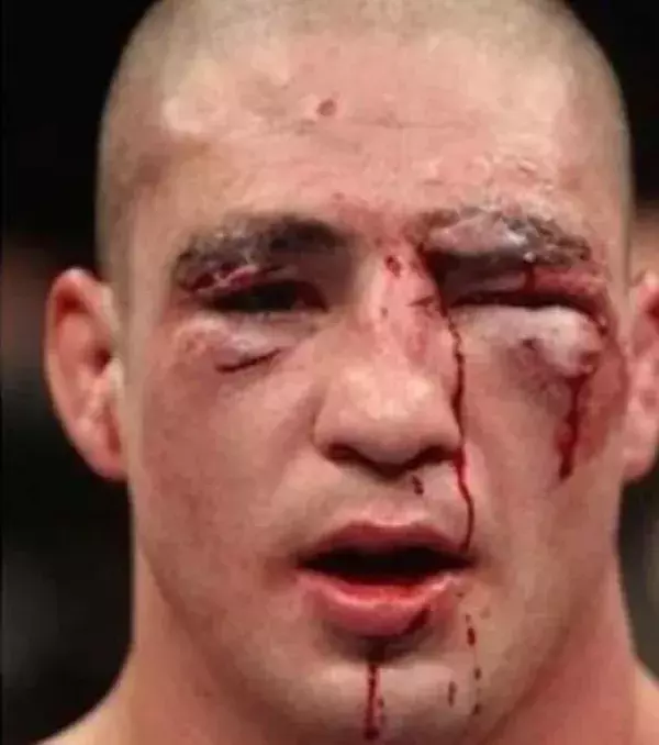 Diego Sanchez nach dem Kampf