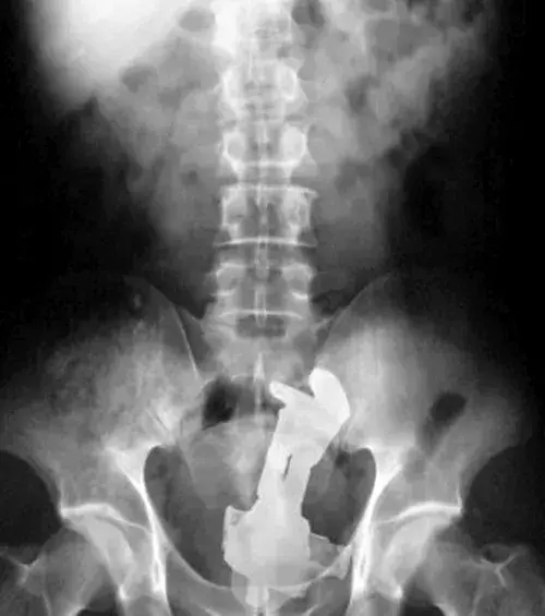 Ein Buzz Lightyear.
