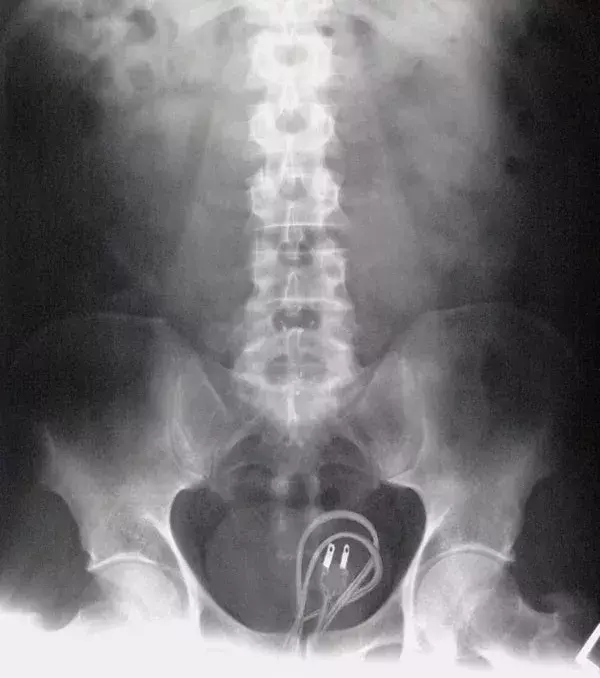 Ein Ladegerät mit Kabel.