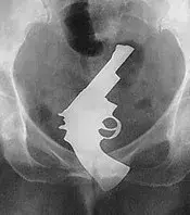Ein Revolver.