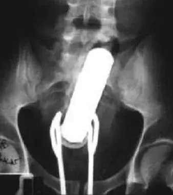 Ein Vibrator.