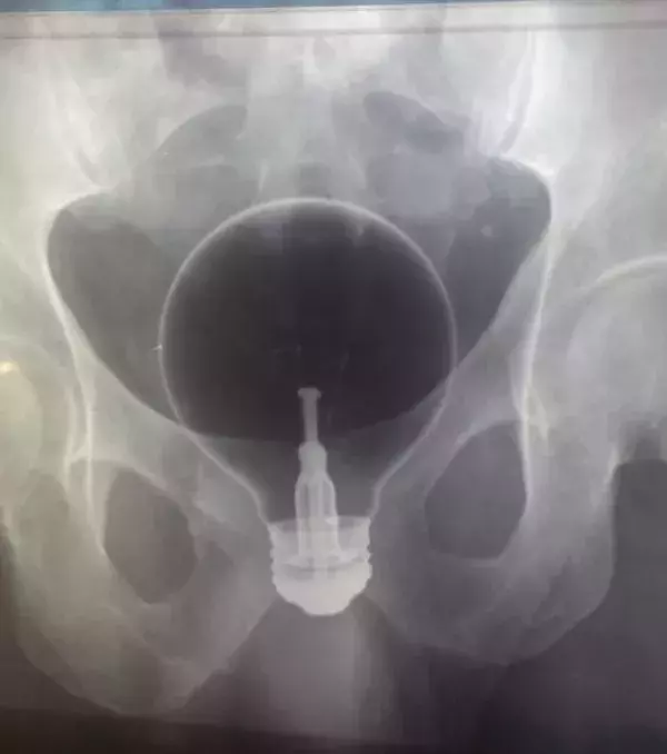 Eine Glühlampe.