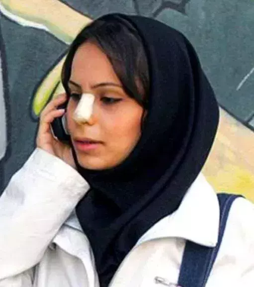 Das Pflaster auf der Nase - Der Look eines Rugbyspielers ist im Iran sehr beliebt. Warum? Die Nasenplastik ist hier sehr verbreitet und das Pflaster zeigt, dass ihr Geld habt…
