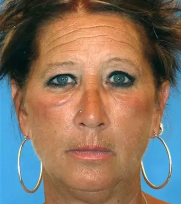 Diese Frau liegt viel in der Sonne und raucht 10 Zigaretten am Tag.