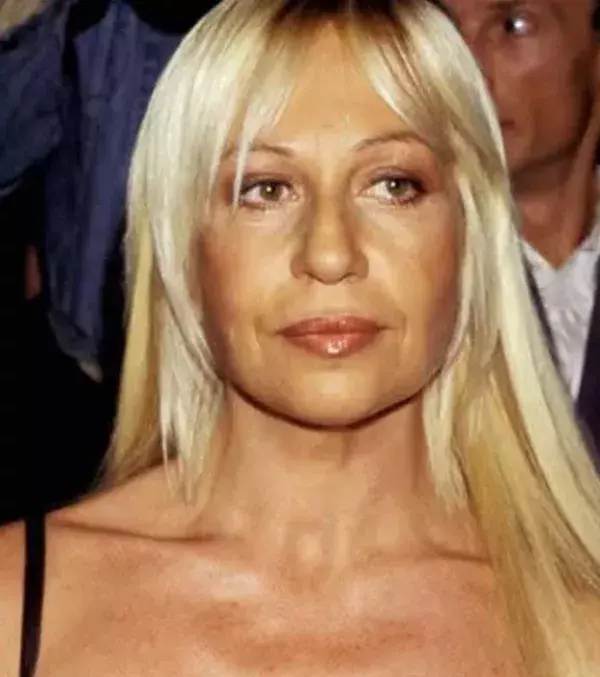 Donatella Visace (62). Die Modedesignerin hat ebenfalls etliche Besuche beim Schönheitschirurgen hinter sich...