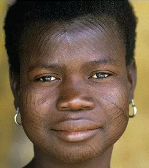 Narben - In Westafrika schnitzen sich viele Menschen Narben ins Gesicht. Sie gelten als Kunstwerk.